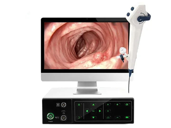 XBX High Definition Medical Endoscope System